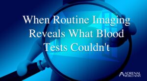 Cushing’ Syndrome. What would you do next?  How doctors reason through data.
